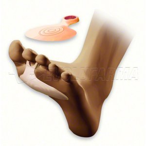 ALMOHADILLA METATARSAL CON ANILLO ALMOHADILLA METATARSAL CON ANILLO